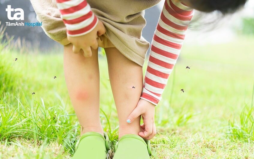 Sốt xuất huyết bao lâu thì khỏi? sai lầm cần tránh để bệnh mau hết